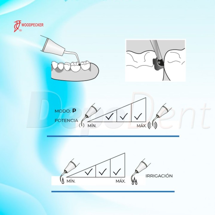 Punta ultrasonidos compatible Satelec SBD3