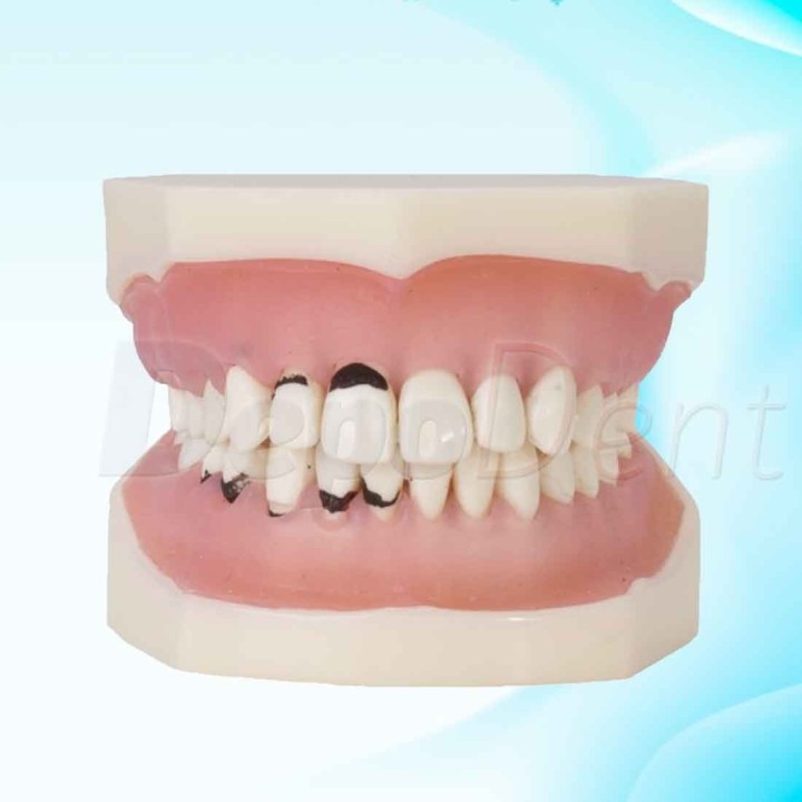 tipodonto periodoncia