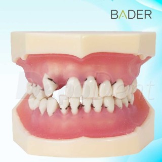Tipodonto de periodoncia