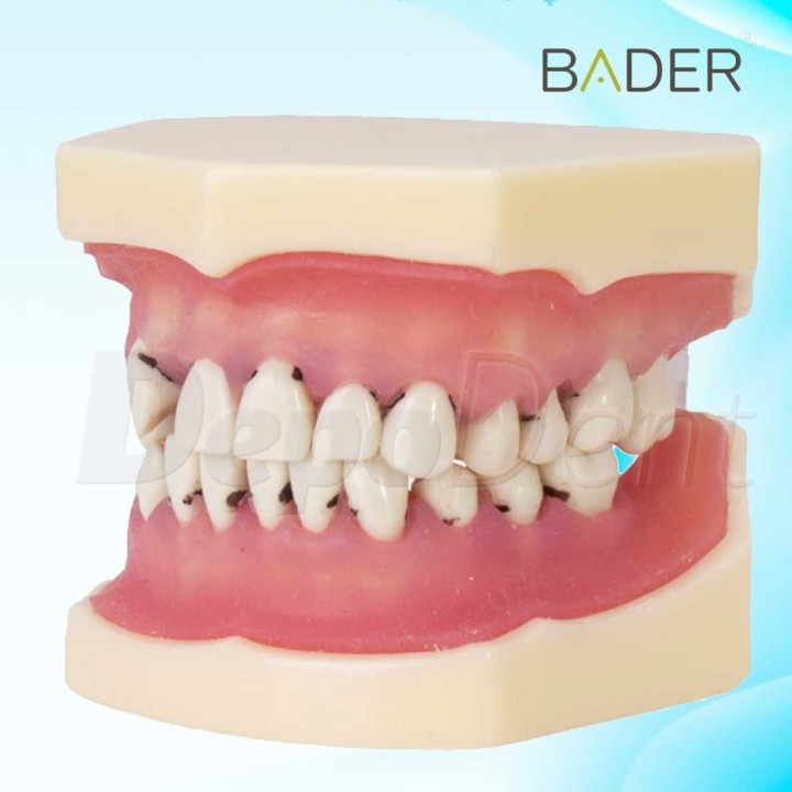 vista Tipodonto de periodoncia