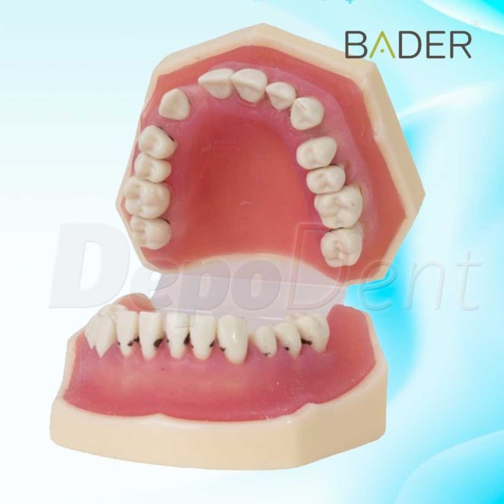 Tipodonto de periodoncia abierto